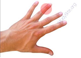 Ring-finger (Oops! image not found)